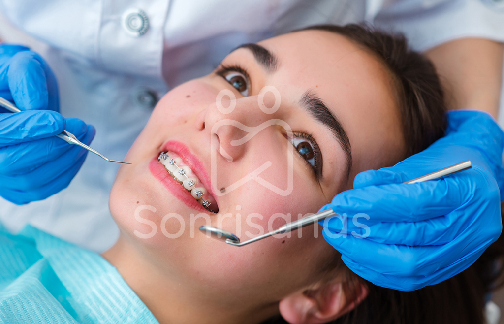 Brackets